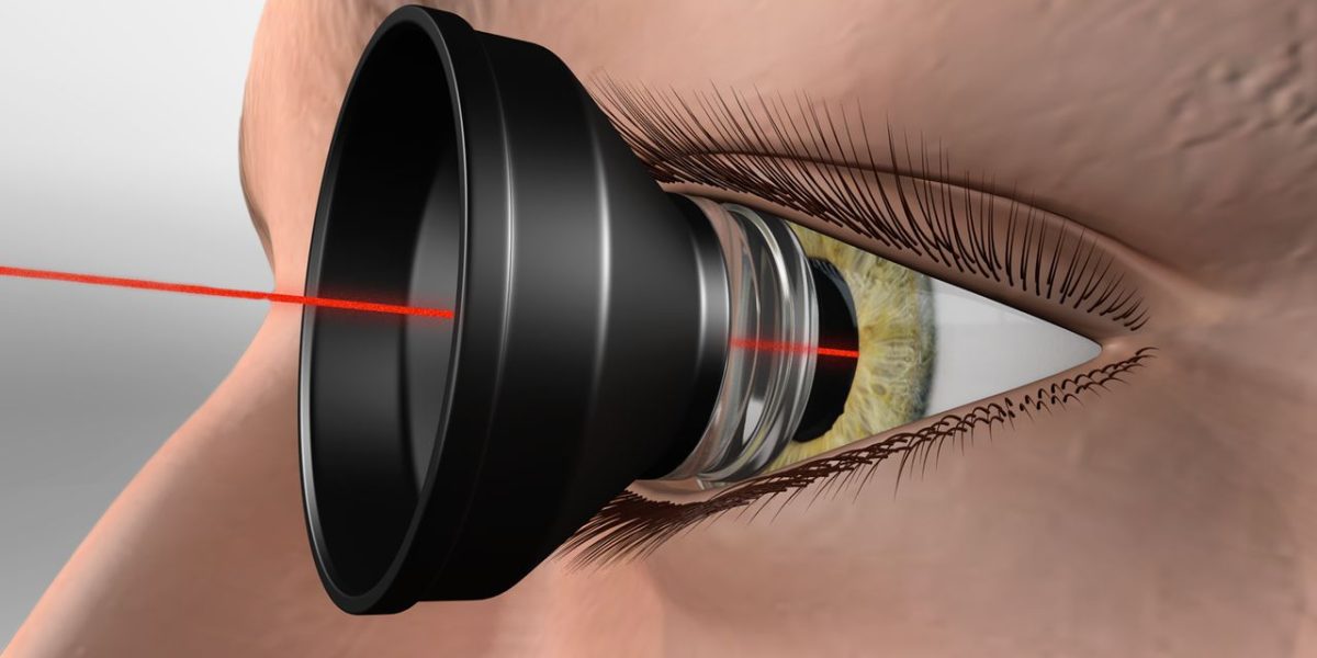 ARGON_LASER_APOFRAKSI2