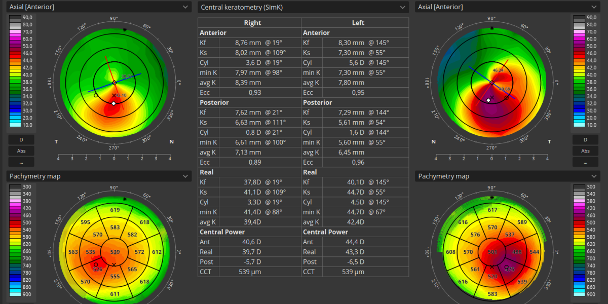 PACHYMETRY2