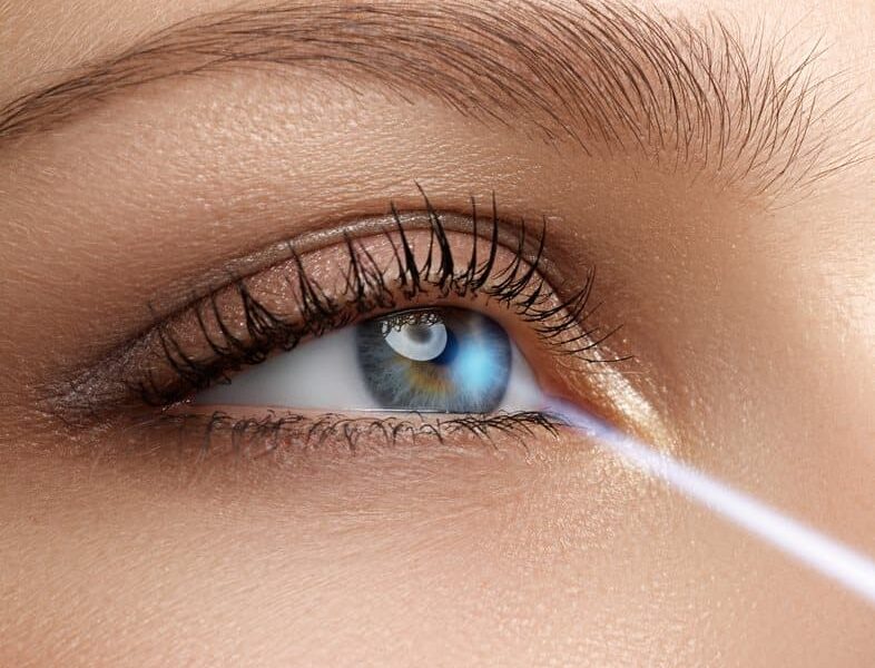 YAG_LASER_IRIDOTOMY2